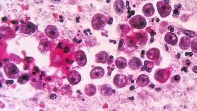 Photo of การกินอะมีบาในสมองกำลังแพร่ระบาดในนักวิทยาศาสตร์สหรัฐฯออกคำเตือนสำหรับ Naegleria fowleri |  Brain Eating Amoeba: อะมีบาที่แพร่กระจายสมองในสหรัฐอเมริกานักวิทยาศาสตร์ออกคำเตือน