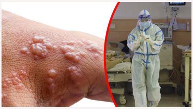 Photo of Monkeypox virus ถึง Kerala รู้อาการ Monkeypox และ samp ข้อควรระวัง |  Monkeypox ในอินเดีย: ไวรัส Monkeypox ที่เป็นอันตรายได้มาถึงอินเดียแล้ว?  เรียนรู้อาการอันตรายที่ควรหลีกเลี่ยง