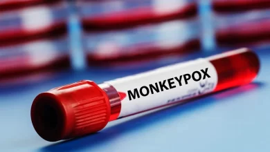 Photo of Monkeypox ภาวะฉุกเฉินด้านสาธารณสุขทั่วโลก WHO Big ประกาศ |  Monkeypox: ภัยคุกคามของ Monkeypox แพร่กระจายใน 60 ประเทศทั่วโลก WHO ได้ประกาศครั้งใหญ่นี้แล้ว