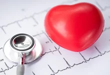 Photo of สุขภาพหัวใจ: เครื่องหมายนี้ในแขนและขาบ่งบอกถึงโรคหัวใจ dil ki bimari อาการหัวใจวาย sscmp |  สุขภาพหัวใจ : สัญญาณของโรคหัวใจยังพบได้จากมือและเท้า ให้ตื่นตัวทันที
