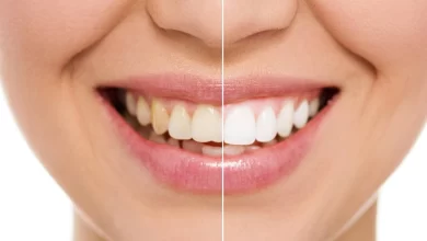 Photo of ทำให้ฟันเหลืองของคุณขาวขึ้นด้วย 5 วิธีดูแลสุขภาพช่องปากในช่องปากให้ขาวใส sscmp |  ทำฟันเหลืองด้วย 5 วิธีแก้ที่บ้าน ลาก่อน รอยยิ้มของคุณจะเปล่งประกาย