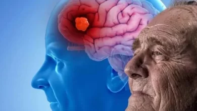 Photo of โรคอัลไซเมอร์ทำร้ายสมองคนสูงวัยมีความเสี่ยง |  วันอัลไซเมอร์โลก โรคร้ายนี้ทำร้ายสมอง คนสูงวัยมีความเสี่ยง